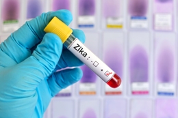 blood sample positive with Zika virus