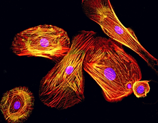 skin cells in which 14-3-3ζ has been inhibited very actively moving around and building a scaffold