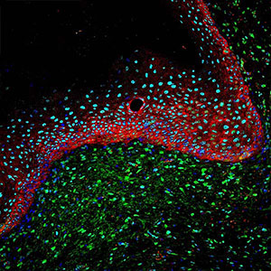 Closing the Gap - wound healing of a diabetic mouse by Natasha Pyne