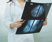 Mammogram film image in female doctor's hands