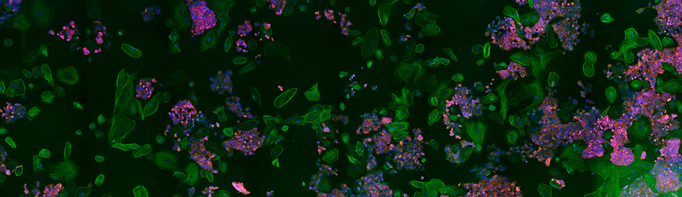 Cells under a microscope