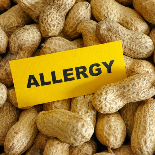 peanut allergyshutterstock_257253946.jpg