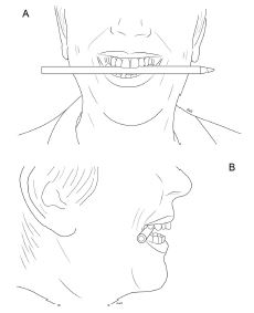 Pen in mouth to induce covert smile