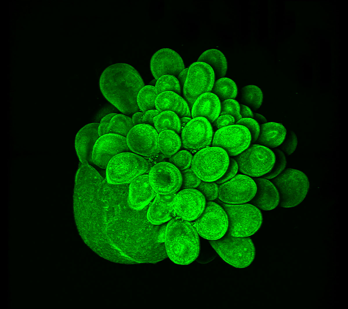 A Blooming Mini Brain by Mariana Oksdath Mansilla