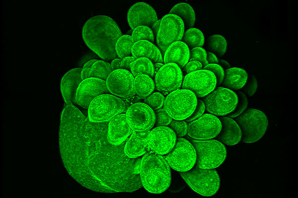A Blooming Mini-Brain