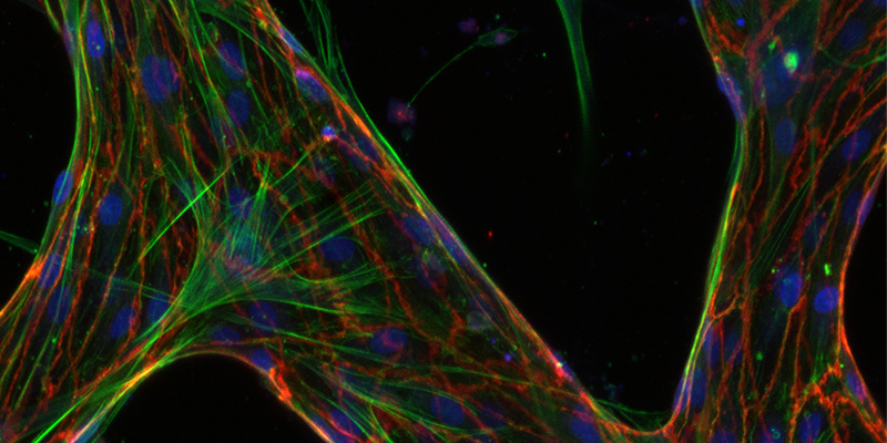 The microvasculature formed inside the chip. Photo by Joe Vittorio.