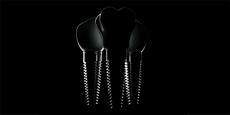 Dental screws